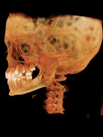 airways 3d imaging i cat